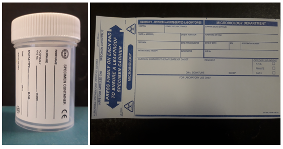 On the left there is a cylindrical sputum sample pot with a twist off lid. On the right is a bag to put the sputum sample in.